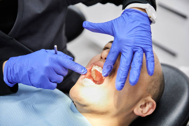 Best Dental Abscess Treatment in Lawrenceville, NJ