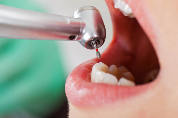 Best Broken or Chipped Tooth Repair in Lawrenceville, NJ